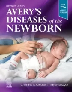 Avery`s Diseases of the Newborn, 11th Edition