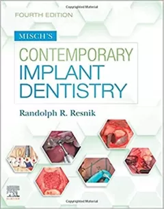 Misch`s Contemporary Implant Dentistry 4th Edition
