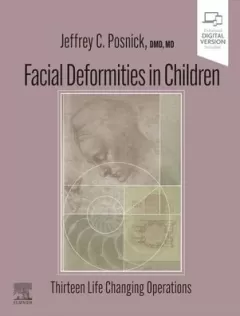 Facial Deformities in Children Thirteen Life Changing Operations