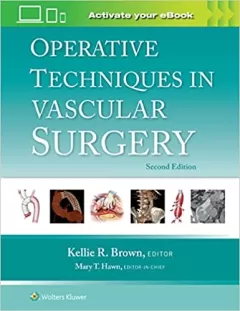 Operative Techniques in Vascular Surgery, 2nd Edition