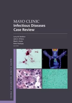 Mayo Clinic Infectious Disease Case Review