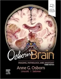 Osborn`s Brain, 3rd Edition