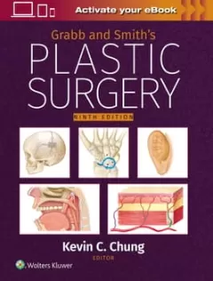 Grabb and Smith`s Plastic Surgery: Print + eBook with Multimedia,9 Edition