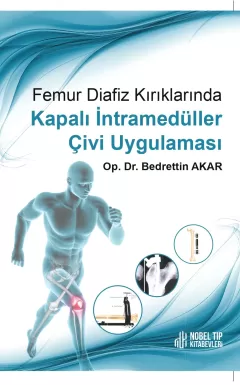 Femur Diafiz Kırıklarında Kapalı İntramedüller Çivi Uygulaması