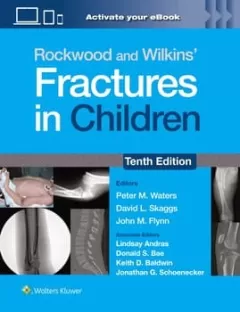 Rockwood and Wilkins` Fractures in Children: Print + eBook with Multimedia 10th Edition