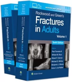 Rockwood and Green`s Fractures in Adults: Print + eBook with Multimedia 10th Edition