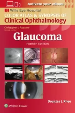 Glaucoma,4 Edition