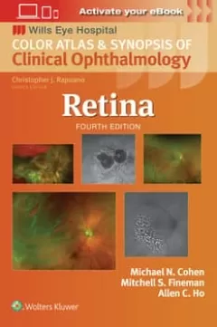 Retina,4 Edition