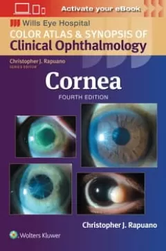 Cornea: Print + eBook with Multimedia,4 Edition