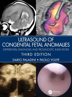 Ultrasound of Congenital Fetal Anomalies Differential Diagnosis and Prognostic Indicators,3rd Edition