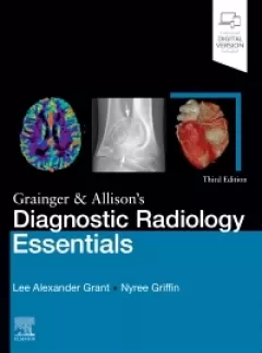 Grainger & Allison`s Diagnostic Radiology Essentials, 3rd Edition
