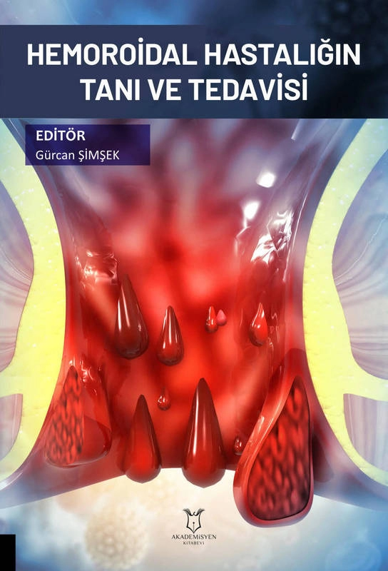 Hemoroidal Hastalığın Tanı ve Tedavisi