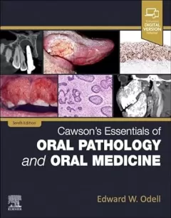 Cawson`s Essentials of Oral Pathology and Oral Medicine, 10th Edition
