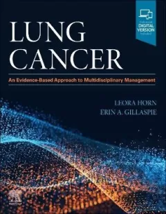 Lung Cancer An Evidence-Based Approach to Multidisciplinary Management