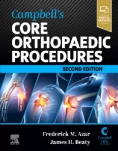 Campbell`s Core Orthopaedic Procedures, 2nd Edition