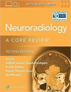 Neuroradiology: A Core Review 2 Edition
