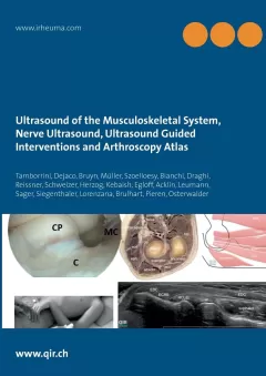 Ultrasound of the Musculoskeletal System, Nerve Ultrasound, Ultrasound Guided Interventions and Arthroscopy Atlas: Musculoskeletal Sonoanatomy Guidelines