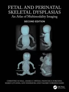 Fetal and Perinatal Skeletal Dysplasias An Atlas of Multimodality Imaging,2nd Edition