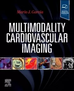 Multimodality Cardiovascular Imaging