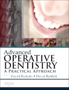 Advanced Operative Dentistry A Practical Approach
