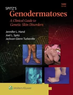 Spitz`s Genodermatoses A Full Color Clinical Guide to Genetic Skin Disorders