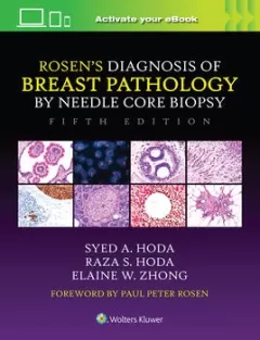  Add to Wish List Rosen`s Diagnosis of Breast Pathology by Needle Core Biopsy