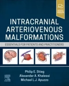 Intracranial Arteriovenous Malformations Essentials for Patients and Practitioners
