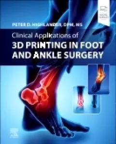 linical Applications of 3D Printing in Foot and Ankle Surgery
