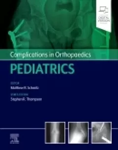 Complications in Orthopaedics: Pediatrics