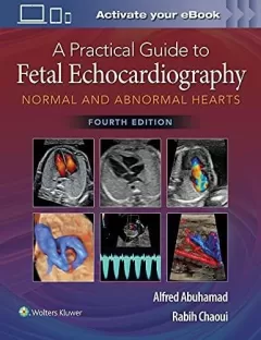 A Practical Guide to Fetal Echocardiography: Normal and Abnormal Hearts Hardcover