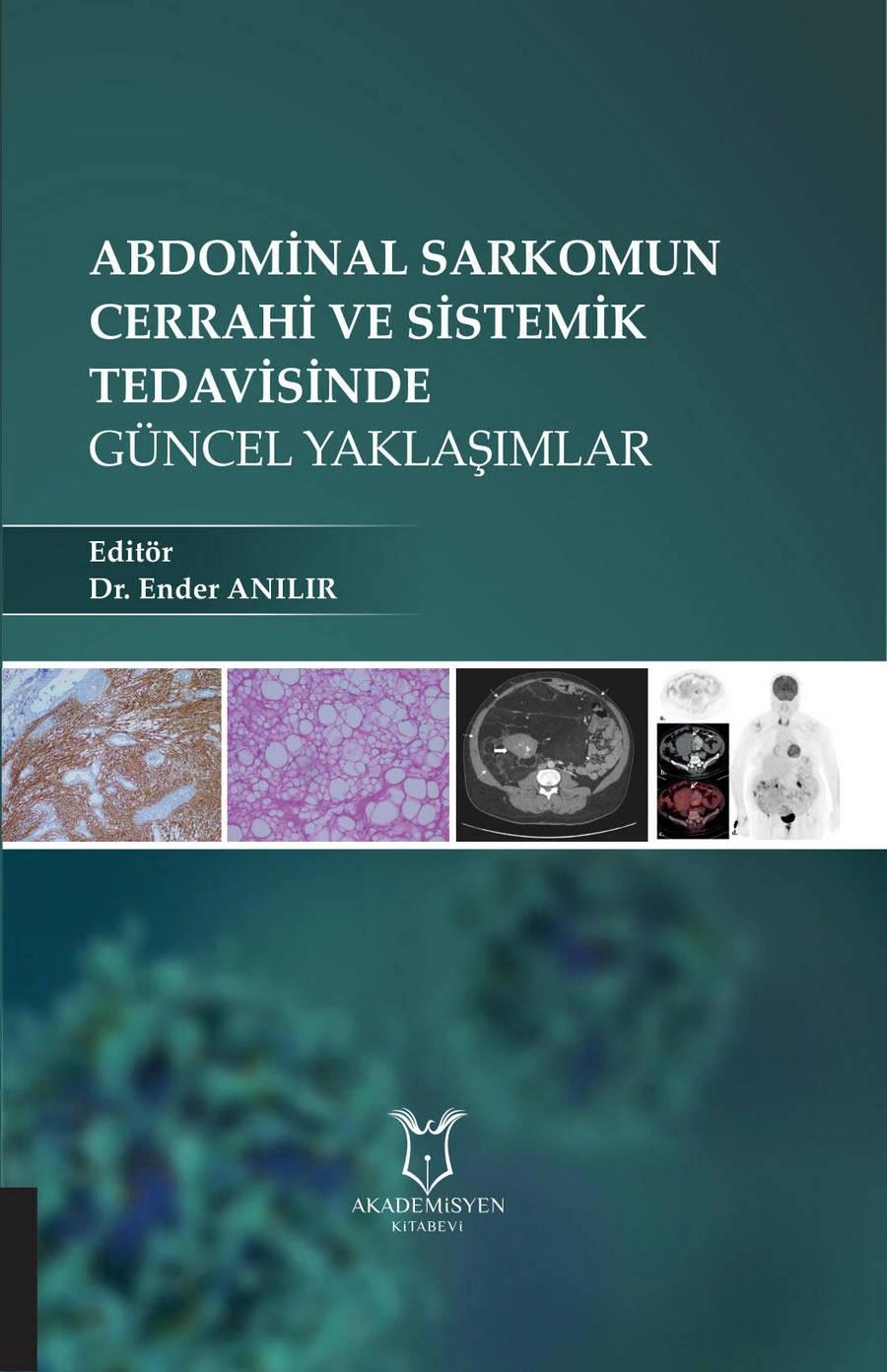 Abdominal Sarkomun Cerrahi ve Sistemik Tedavisinde Güncel Yaklaşımlar