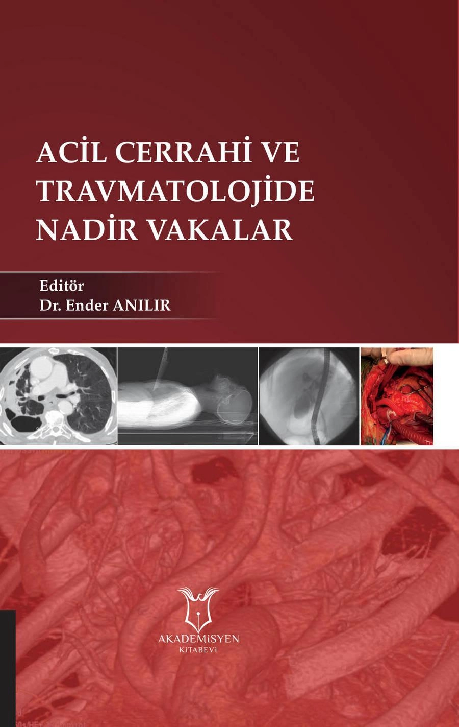 Acil Cerrahi ve Travmatolojide Nadir Vakalar