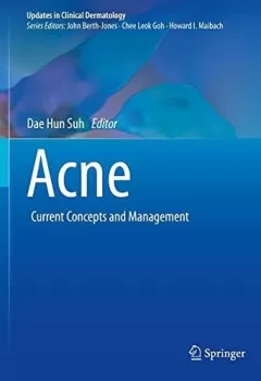 Acne Current Concepts and Management