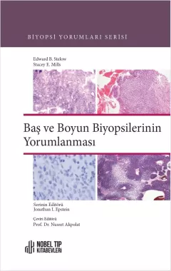 Baş ve Boyun Biyopsilerinin Yorumlanması