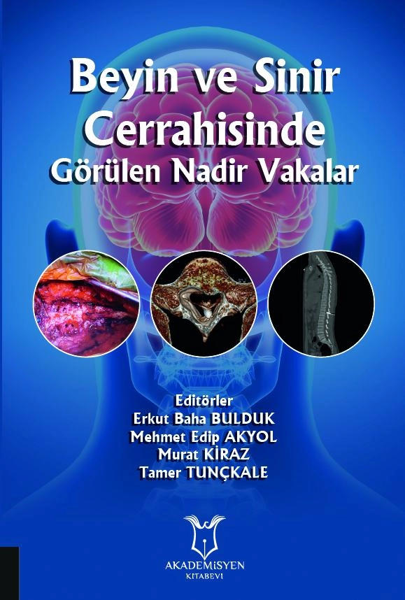 Beyin ve Sinir Cerrahisinde Görülen Nadir Vakalar