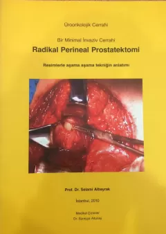 Bir Minimal İnvaziv Cerrahi Radikal Perineal Prostatektomi