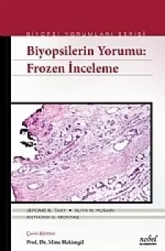 Biyopsilerin Yorumu: Frozen İnceleme Biyopsi Yorumları Serisi