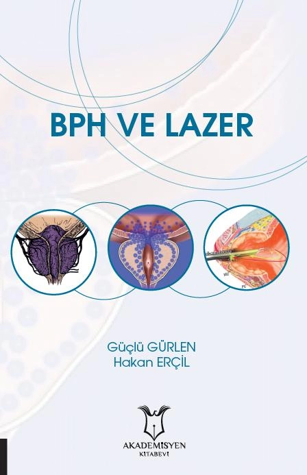 BPH ve Lazer