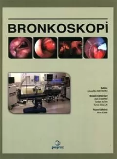 Bronkoskopi