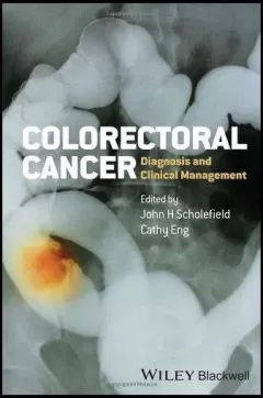Colorectal Cancer: Diagnosis and Clinical Management 1st Edition