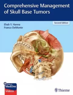 Comprehensive Management of Skull Base Tumors