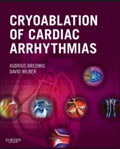 Cryoablation of Cardiac Arrhythmias