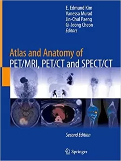 Atlas and Anatomy of PET/MRI, PET/CT and SPECT/CT 2nd Edition