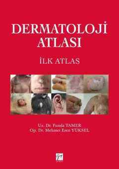 Dermatoloji Atlası- ilk Atlas