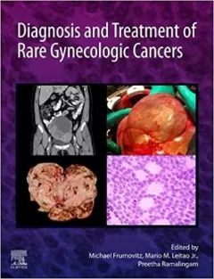 Diagnosis and Treatment of Rare Gynecologic Cancers