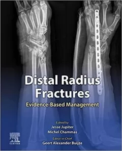 Distal Radius Fractures Evidence-Based Management