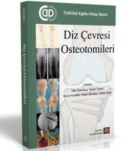 Diz Çevresi Osteotomileri