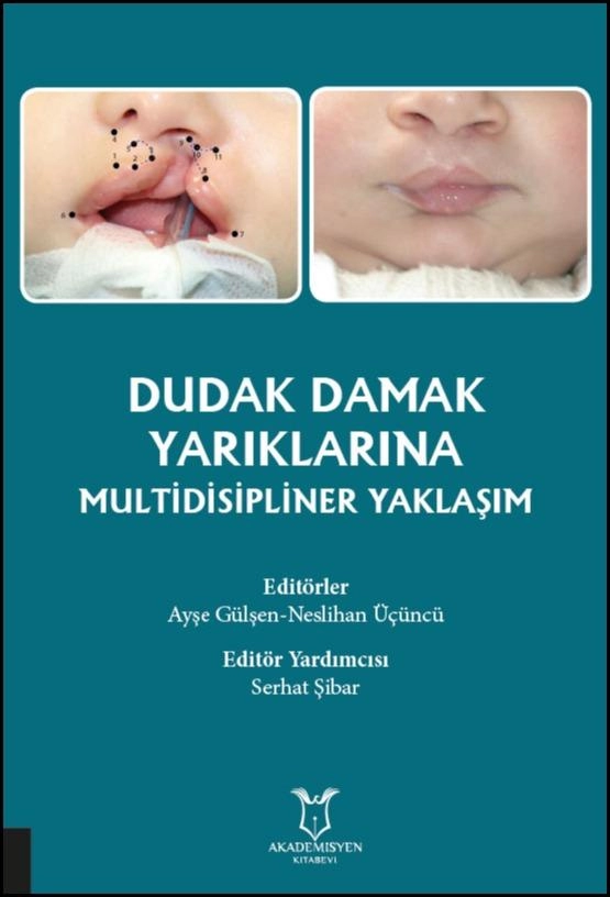 Dudak Damak Yarıklarına Multidisipliner Yaklaşım