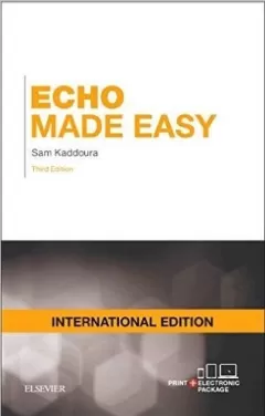 Echo Made Easy Paperback