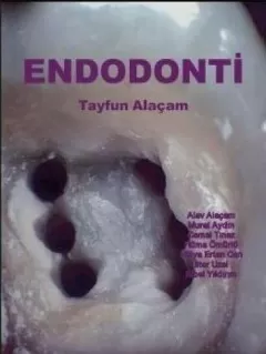 Endodonti,Tayfun Alaçam 